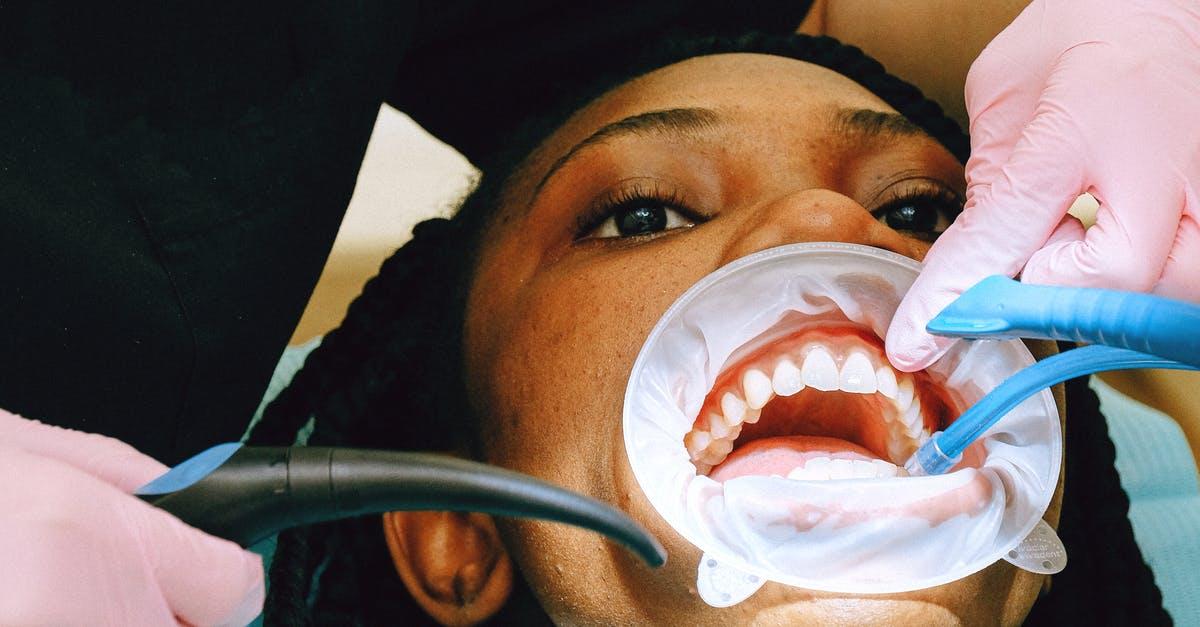 Få dit drømmesmil med en professionel tandblegning